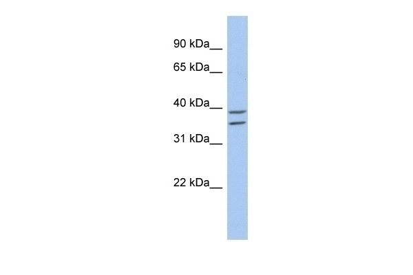 ZADH2 Antibody