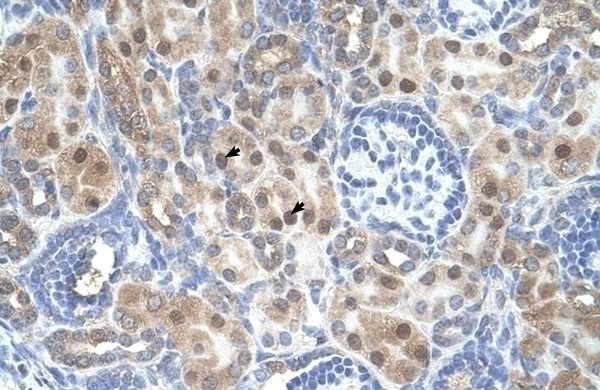 ARMCX6 Antibody