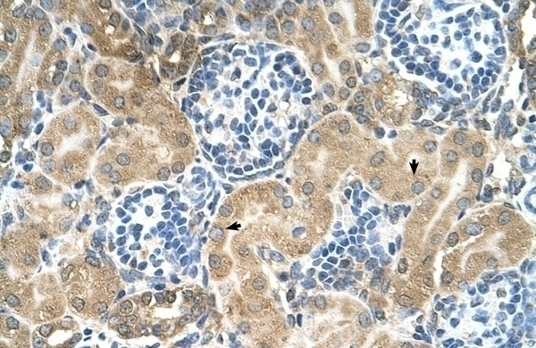 TM9SF1 Antibody