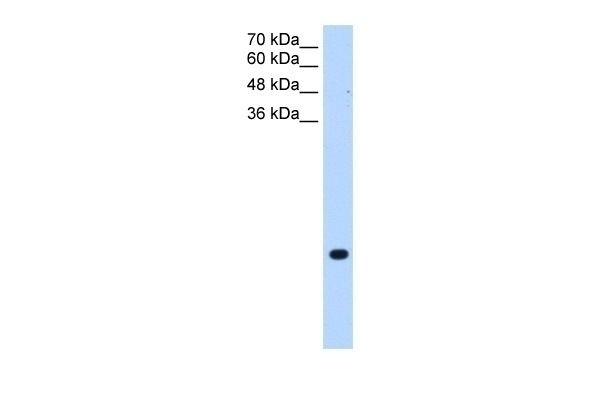 TMEM75 Antibody