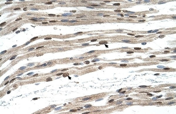 SIL1 Antibody