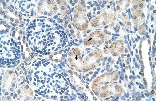 SPPL2B Antibody