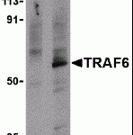 Western blot analysis of TRAF6 in PC-3 cell lysates with TRAF6 antibody at 1 μg/mL in the presence (A) or absence (B) of 1 μg blocking peptide (3129P).