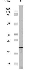 4E-BP1 Antibody [11G12C11]