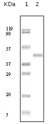 ABL2 Antibody [1H1B11]