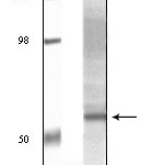 Western blot analysis using Akt3 monoclonal antibody against truncated Akt3 recombinant protein and human ovary carcinoma tissue lysate .