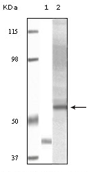 Akt3 Antibody [3B12F3F10 / 2D2B11B11 / 2D2B11H5]