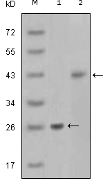 AMACR Antibody [2A10F3]