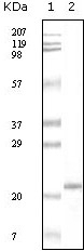 Apoa5(bd) Antibody [4H8H8E2(c)]