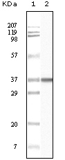 BLK Antibody [9D10B7H6 / 9D10A8F8]