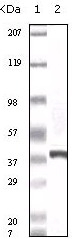 Calcyclin Antibody [7D11A8]