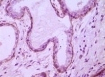 CD10 Antibody [2A1H5E1]