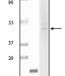 Westernblot analysis using anti - human fibulin 5 monoclonal antibody agaist truncated Fibulin 5 recombinant protein and Hela lysate.