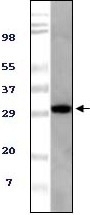 TUG Antibody [4A11A6G11]