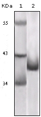 P16 Antibody [1E12E10]