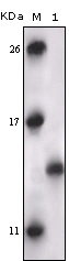 PRAK Antibody [7H10B4]