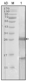 PSA Antibody [5A11E9]