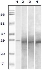 Rab25 Antibody [3F12F3]