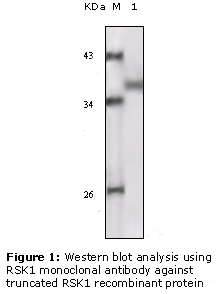 RSK1 Antibody [10B1D7A9 / 10B1D7E12]