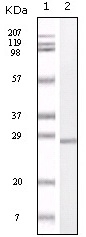 S100A Antibody [2C8B8 / 2C8E8]