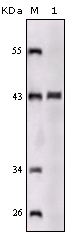 SORL1 Antibody [3B6A9 / 3B6B11]