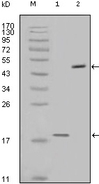 Survivin Antibody [2H5H2]