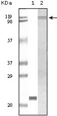 Tyk2 Antibody [8G8E9 / 8G9H5]