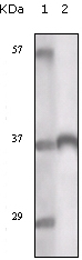 TYRO3 Antibody [1C10E8 / 9A3F2]
