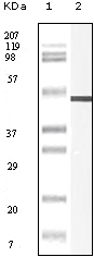 Vimentin Antibody [9E7E7 / 5G3F10]