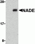 Western blot analysis of NADE in Human brain cell lysates with NADE antibody at 1 μg/mL in the presence (A) or absence (B) of blocking peptide (3359P).