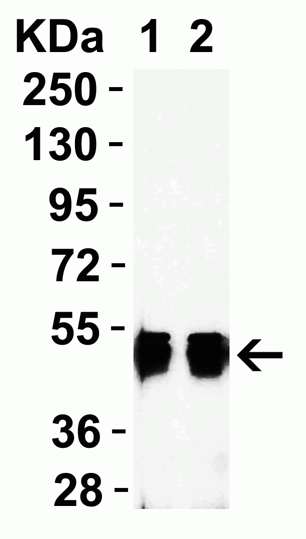 SARS-CoV-2 (COVID-19) Nucleoprotein Antibody [3861]