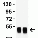 <strong>Figure 1 Western Blot Validation with Human Recombinant Protein</strong><br> Loading: 50 ng per lane of human nucleocapsid recombinant protein. Antibodies: SARS-CoV-2 nucleocapsid, 35-712, 1h incubation at RT in 5% NFDM/TBST. Secondary: Goat anti-mouse IgG HRP conjugate at 1:5000 dilution. Lane 1: 0.5  μg/mL Lane 2: 1  μg/mL