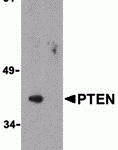 Western blot analysis of PTEN in PC-3 cell lysate with PTEN antibody at 1 μg/mL in either the (A) absence or (B) presence of blocking peptide (3515P).