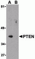 PTEN Peptide