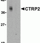 Western blot analysis of CTRP2 in Caco-2 cell lysate with CTRP2 antibody at 1 μg/mL in either the (A) absence or (B) presence of blocking peptide (3561P).