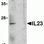 Western blot analysis of IL-23 in Raji lysate with IL-23 antibody at 1 μg/mL in the (A) absence and (B) presence of blocking peptide (3793P).