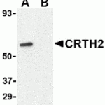 Western blot analysis of CRTH2 in Jurkat cell lysate with CRTH2 antibody at 1 μg/mL in (A) the absence and (B) presence of blocking peptide.