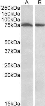 STK39 Antibody