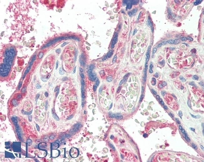 TXK Antibody