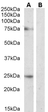ARR3 Antibody