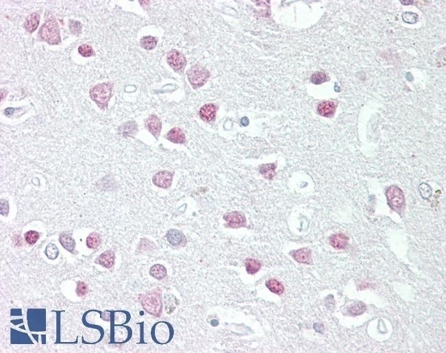 TREX2 Antibody