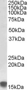 SLC10A2 Antibody