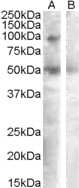 SFRP4 Antibody