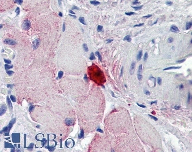 THBS3 Antibody