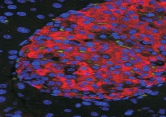 ATG4D Antibody