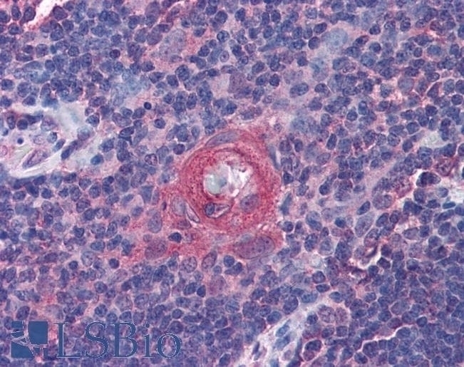 ADCYAP1 Antibody
