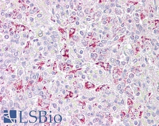 TET2 Antibody