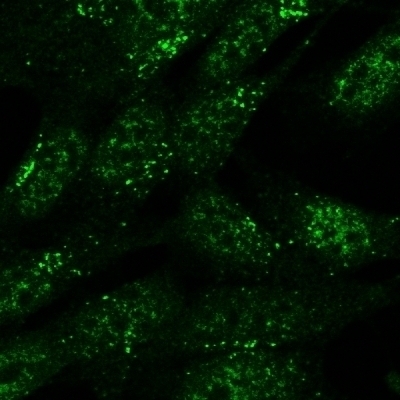 SLC4A11 Antibody