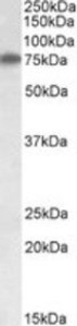 RARS Peptide