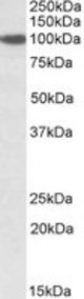 SEC23A Peptide
